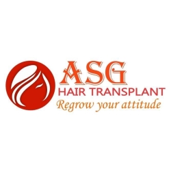 Is a hair transplant a permanent cure to hair loss?