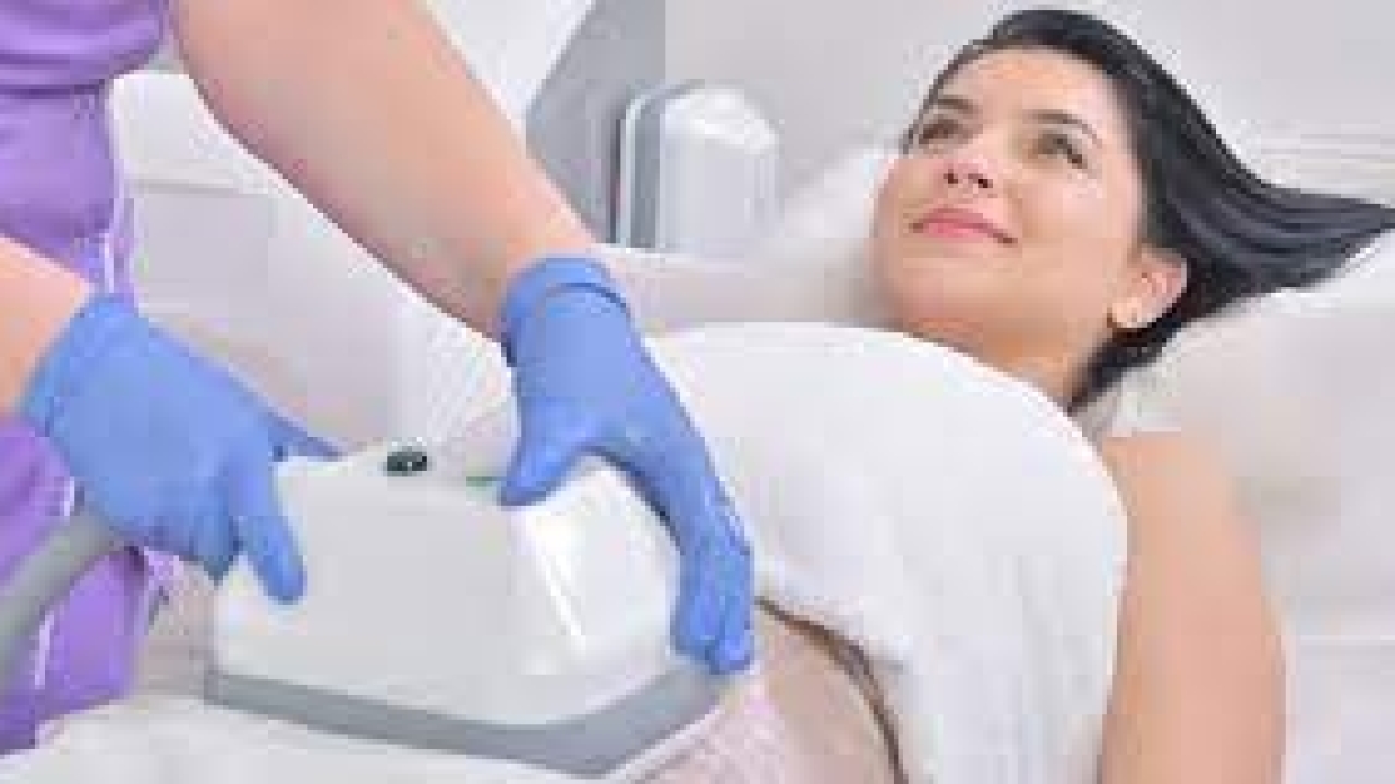 Complete Guide to Best CoolSculpting Services in Los Angeles