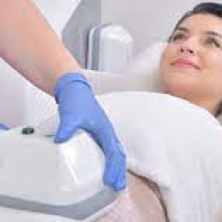 Complete Guide to Best CoolSculpting Services in Los Angeles