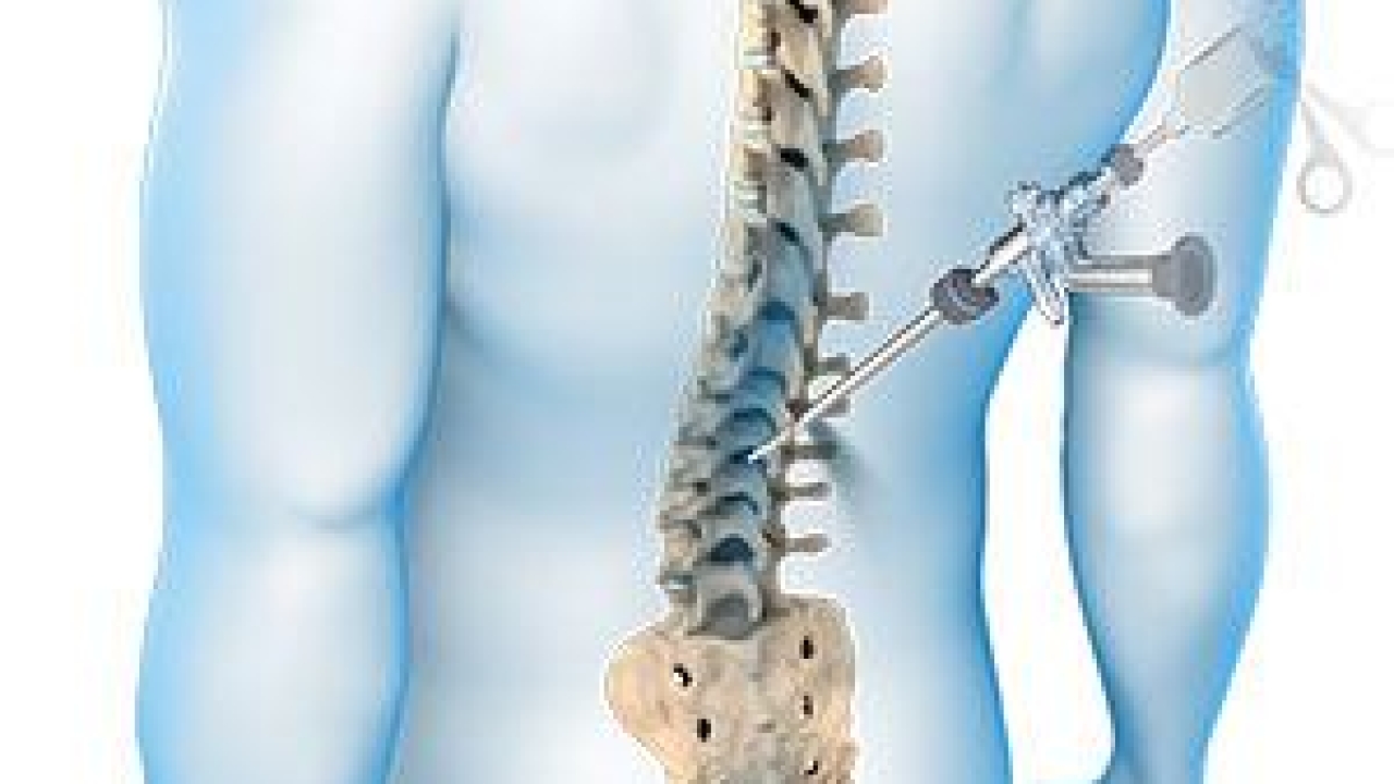 Revolutionising Spine Care: The Game-Changing Benefits of Less Invasive Surgery