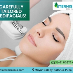 Skin allergies Treatment in kothrud