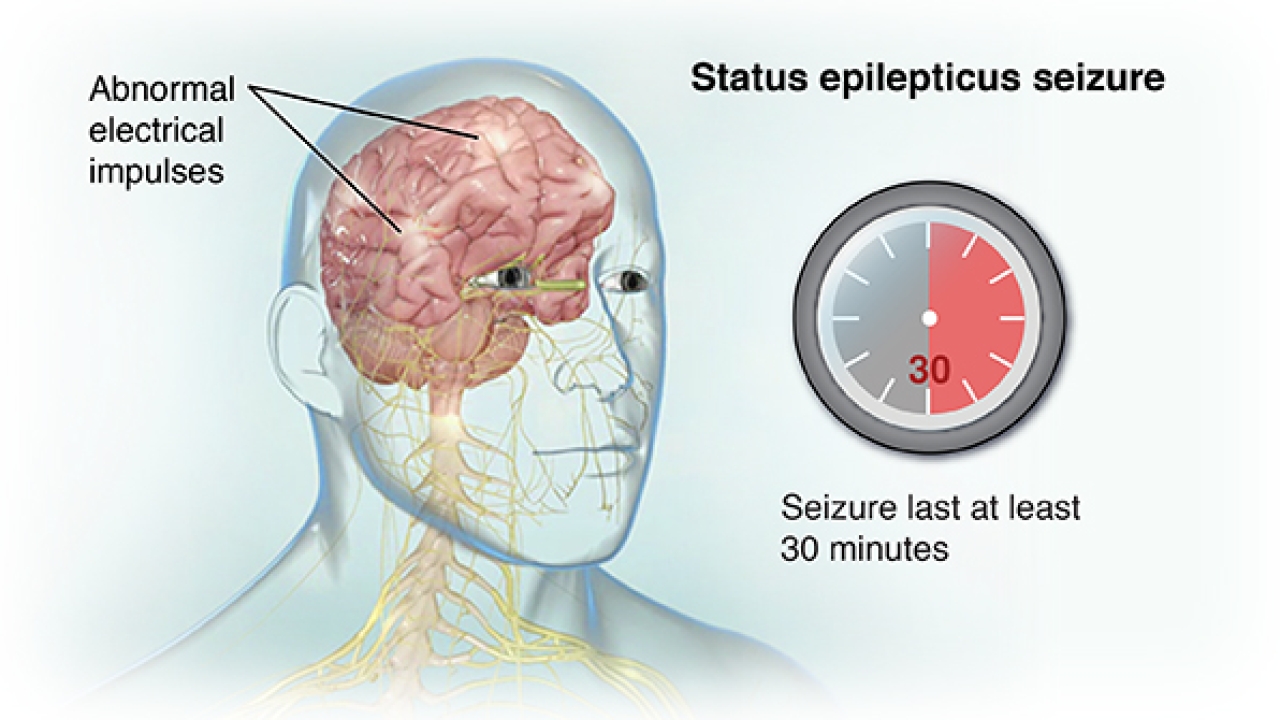 Status Epilepticus Market Size 2023: Epidemiology, Industry Overview, Growth, Trends, Opportunities and Forecast to 2033