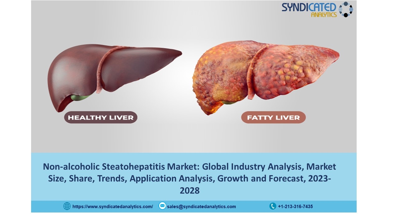 Non-alcoholic Steatohepatitis Market Size 2023: Share, Price Trends, Industry Analysis and Forecast 2028 | Syndicated Analytics