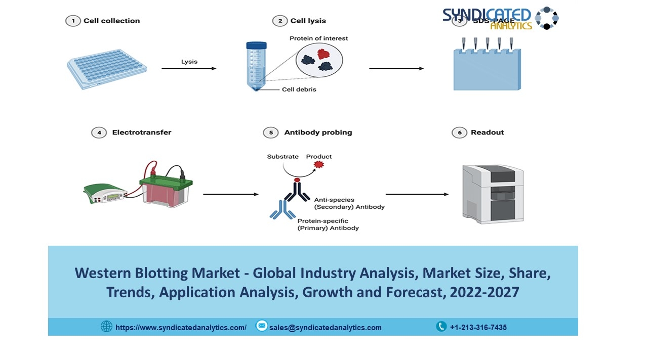 Western Blotting Market Report 2022: Size, Share, Price Trends, Growth, Industry Analysis, Opportunities and Forecast till 2027 - Syndicated Analytics