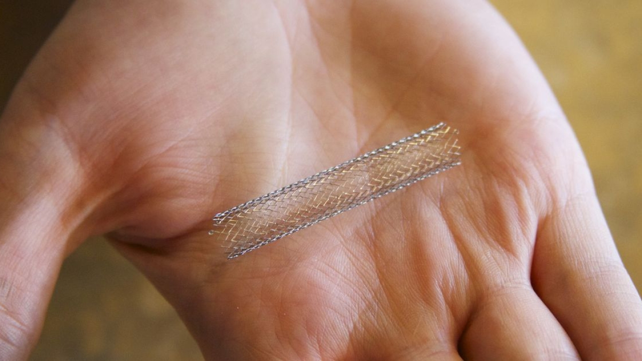 Power of Stents: Essential Facts You Shouldn't Miss