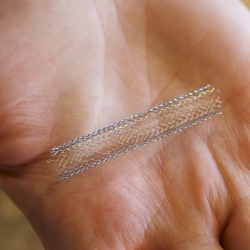 Power of Stents: Essential Facts You Shouldn't Miss