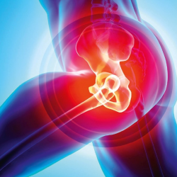 What Do You Need to Know About the Causes of Hip Pain?