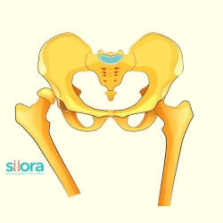 Hip Dislocation - An Educational Guide