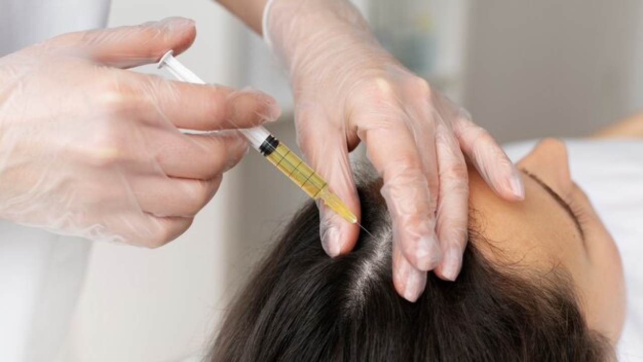 Unlock the Way Towards Healthy and Thick Hair With The PRP Treatment: PRP Hair Loss Treatment In Vizag | VJ’s Cosmetology Clinic