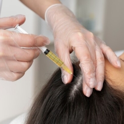 Unlock the Way Towards Healthy and Thick Hair With The PRP Treatment: PRP Hair Loss Treatment In Vizag | VJ’s Cosmetology Clinic