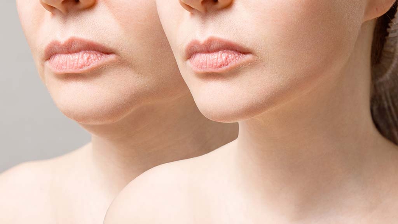 Non-Surgical Alternatives to Facelifts: What You Need to Know