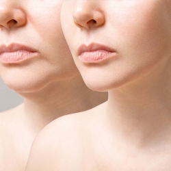 Non-Surgical Alternatives to Facelifts: What You Need to Know